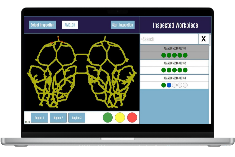 Microvista Cloud Software zur automatisierten CT-Auswertung