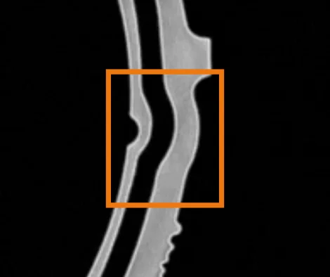 Schwankende Wandstärken im Statorgehäuse