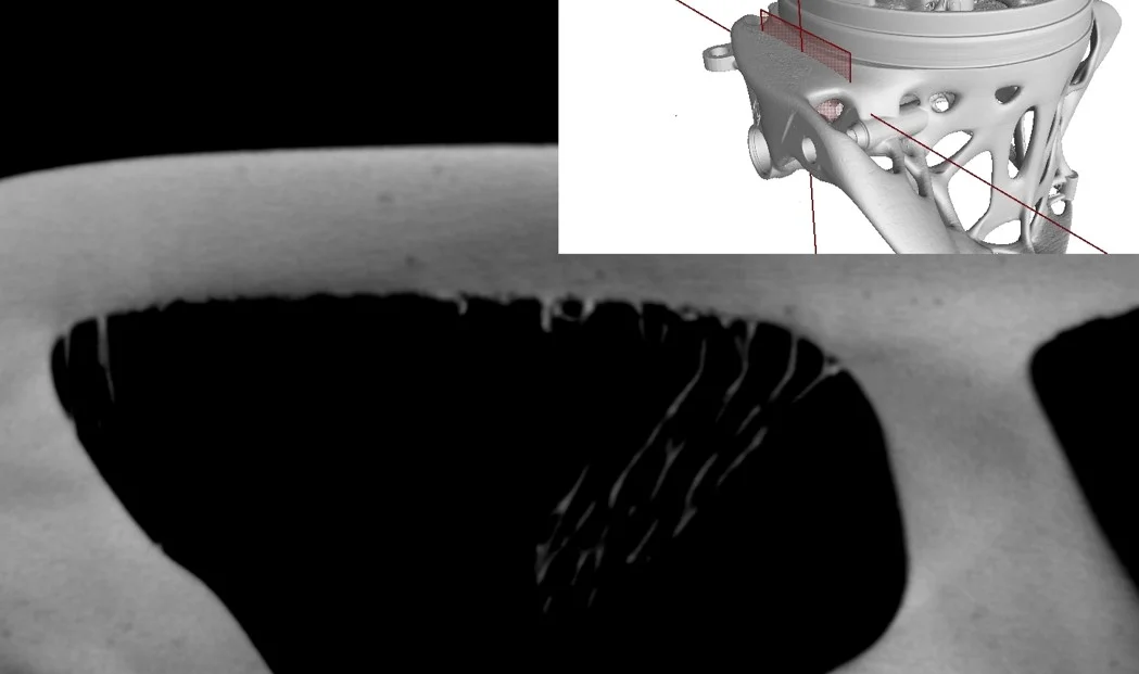 Stütztstrukturreste im CT-Bild - Prüfung additiv gefertigter Bauteile